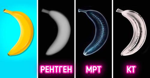 Какая разница между МРТ и КТ Какая разница между МРТ и КТ